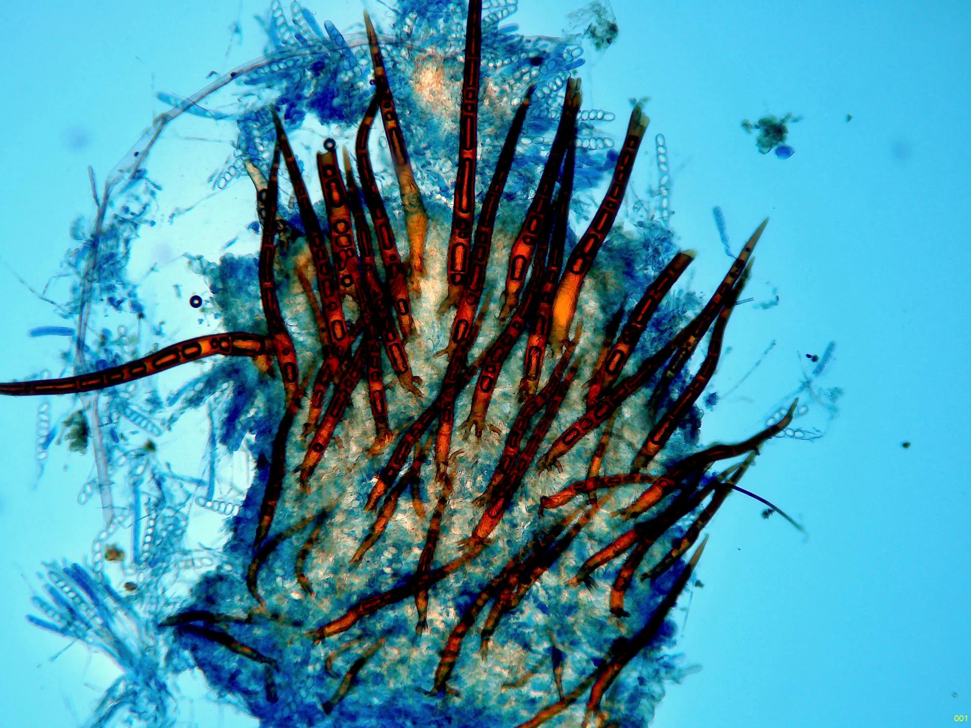 Microscopía de Scutellinia setosa - 10 - Pelos azulde Lactofenol-001